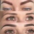 Eyebrow Tattooing: Options for Removal and Correction