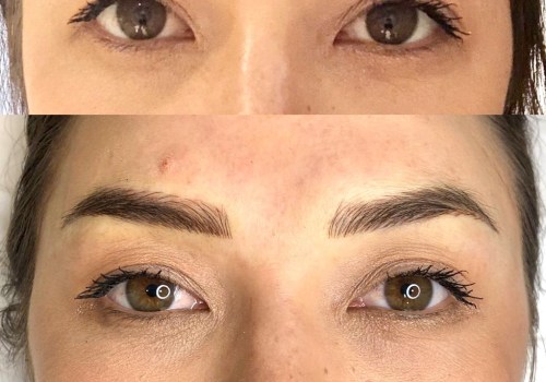 Understanding Different Techniques of Eyebrow Tattooing