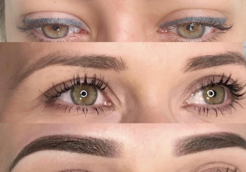 Eyebrow Tattooing: Options for Removal and Correction